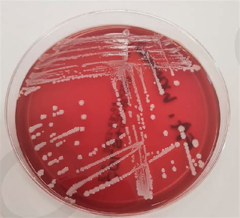 Staphylococcus Warneri Colonies On Agar Containing 5 Sheep Blood