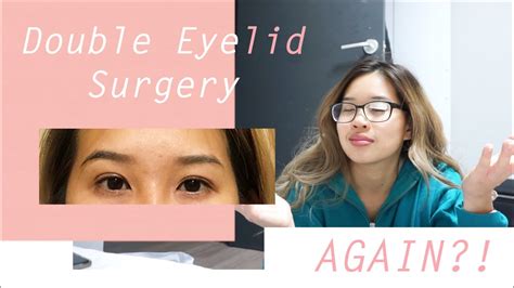 Double Eyelid Surgery In Korea Again Watch Me Recover Non