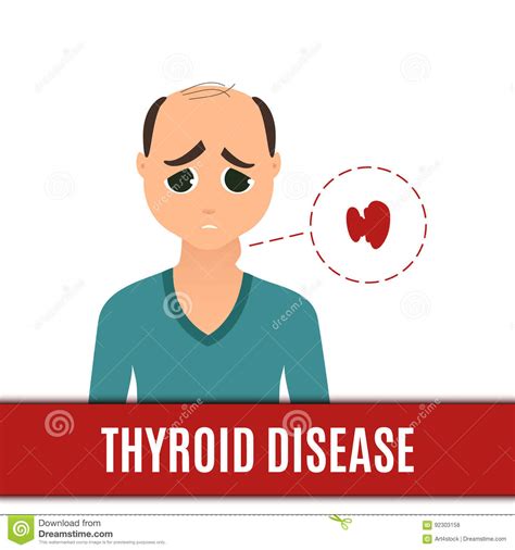 Thyroid Disorder In Men Stock Vector Illustration Of Human 92303158