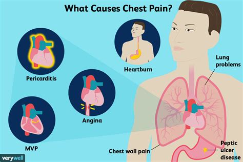 Pain In Chest Causes And Signs Of A Medical Emergency