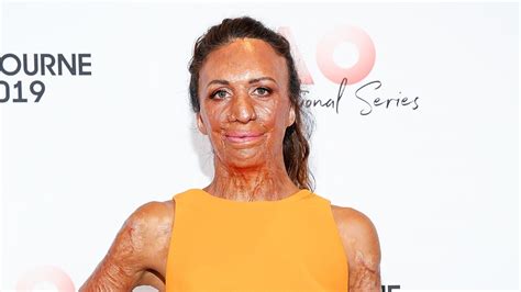 The Intimate Family Pictures Of Turia Pitt Before The Fire That Almost Took Her Life Oversixty