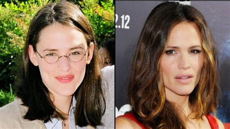 Just make sure you are doing this for yourself. Jennifer Garner Nose Job
