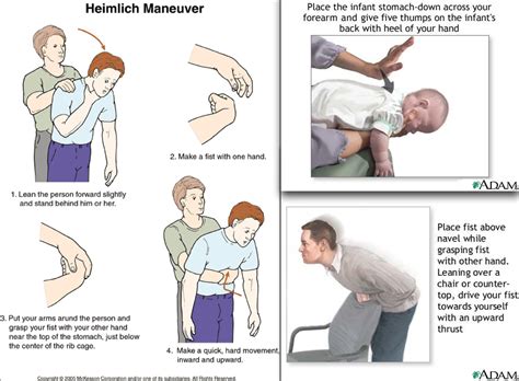 steps for the heimlich maneuver ｜ matt s blog