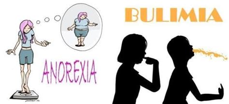 La Anorexia Diferencias Y Semejanzas Entre Bulimia Y Anorexia