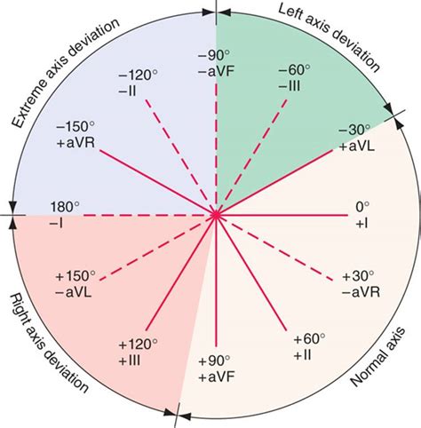 12 Lead ECG Axis Deviation