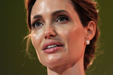 Commonly used medications to treat bell's palsy include: Angelina Jolie diagnosis: What is Bell's palsy?