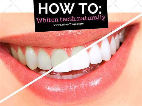 You can whiten your teeth in this natural way. How to whiten your teeth naturally