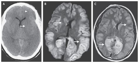 Case 21 2010 — A Request For Retrieval Of Oocytes From A 36 Year Old