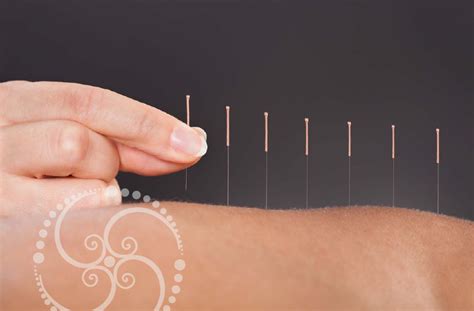 Acupuncture Helps Pre And Post Surgery Srq Acupuncture And Massage