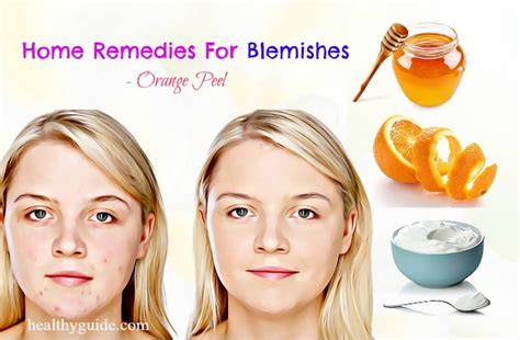 11 Natural Home Remedies For Blemishes On Face Cheeks Nose Legs