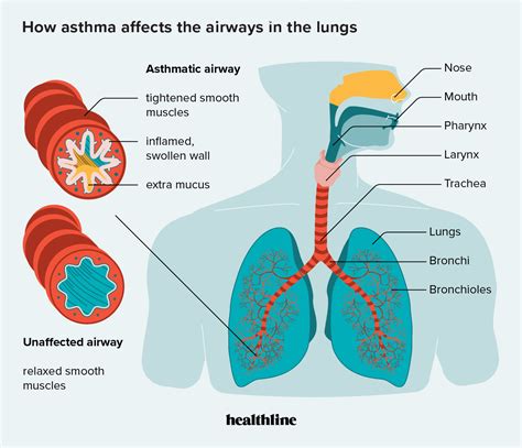 How Does Asthma Affect The Respiratory System
