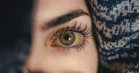 Yellow Eyes Causes And Treatment All About Vision
