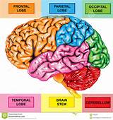 Pictures of Cerebro Medical Term