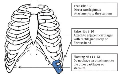 Slipping Rib Syndrome In An Adolescent Wrestler Bmj Case Reports