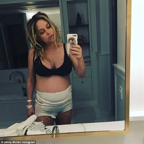Jenny Mollen Shows C Section Scar After Sons Birth Daily Mail Online