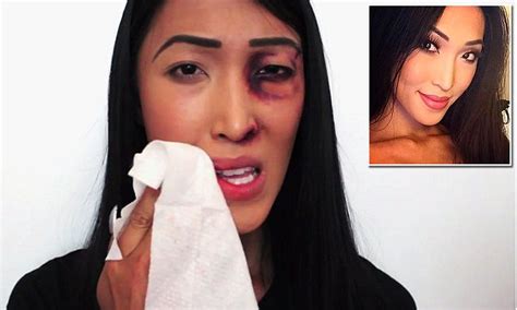 Transgender Youtube Star Shines A Light On Domestic Violence In