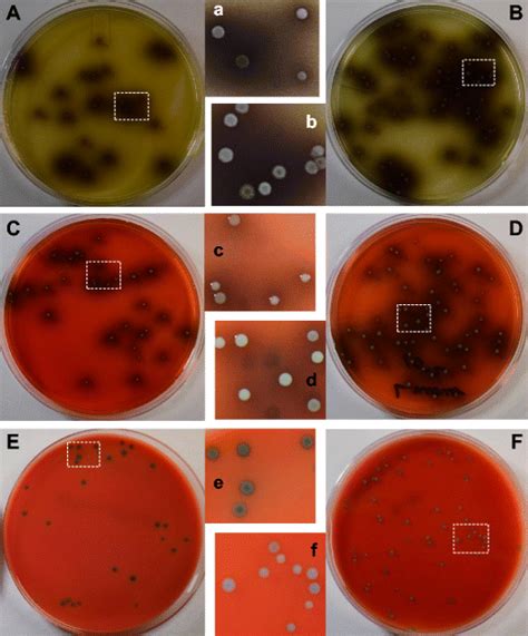 Photographic Composite Showing The Morphology Of Colonies Formed By