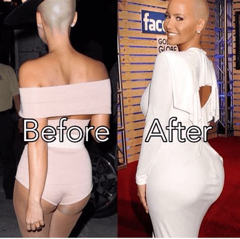 Amber Rose Butt Implant Plastic Surgery Celebrity Bra Size Body Measurements And Plastic Surgery