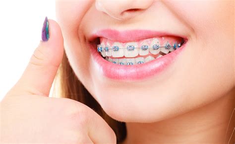 How Do You Maintain Braces Tips On Caring For Metal Braces