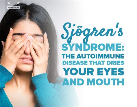 Sjögrens Syndrome The Autoimmune Disease That Dries Your Eyes And