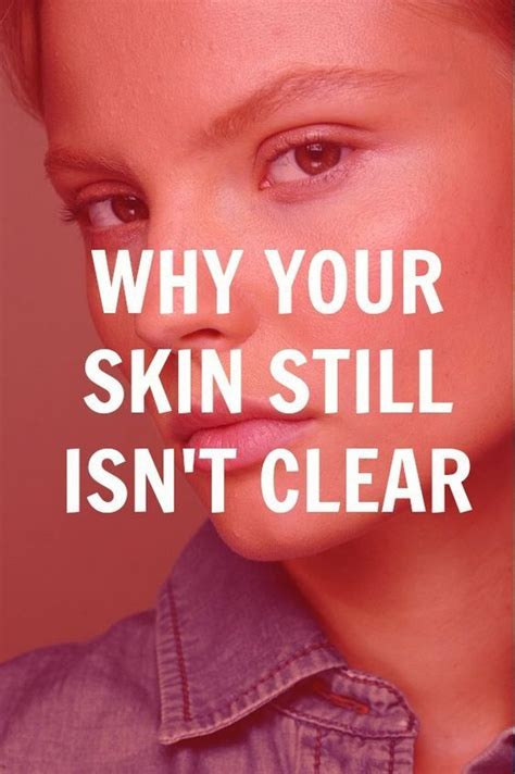 Reasons Why Your Skin Still Isnt Clear Yet Skin Tips Clear Skin