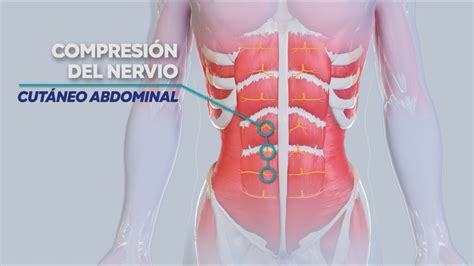 Acnes Dolor Abdominal