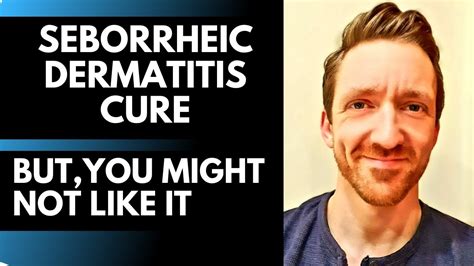 Seborrheic Dermatitis Cure This Works But You Might Not Like It Youtube