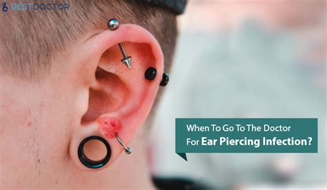 when to go to the doctor for ear piercing infection [and what to expect]