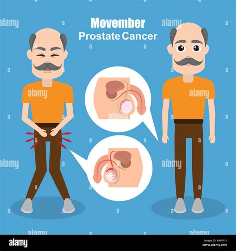 Movember Prostate Cancer Stock Vector Image And Art Alamy