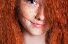 freckles redheads ginger freckled malyna heads genetic
