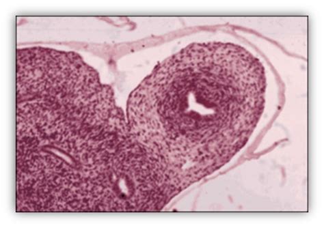 Figure 15 [müllerian Ducts Develop Into The Uterus And Fallopian Tubes] Endotext Ncbi