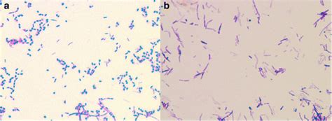 Gram Stain Of Nocardia Farcinica Showing Gram Positive Rod Shaped