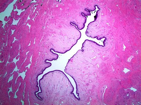 pathology outlines anatomy and histology male urethra