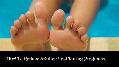 Causes How To Reduce Swollen Feet During Pregnancy