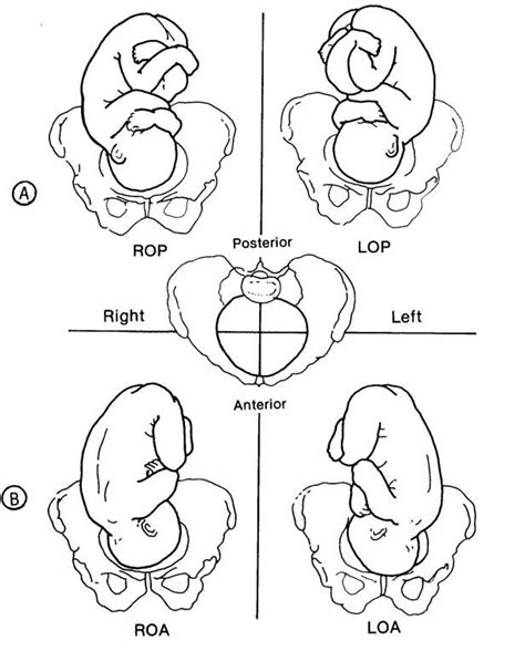 Fetal Positions And Adaptations Newborn Nursing Neonatal Nurse