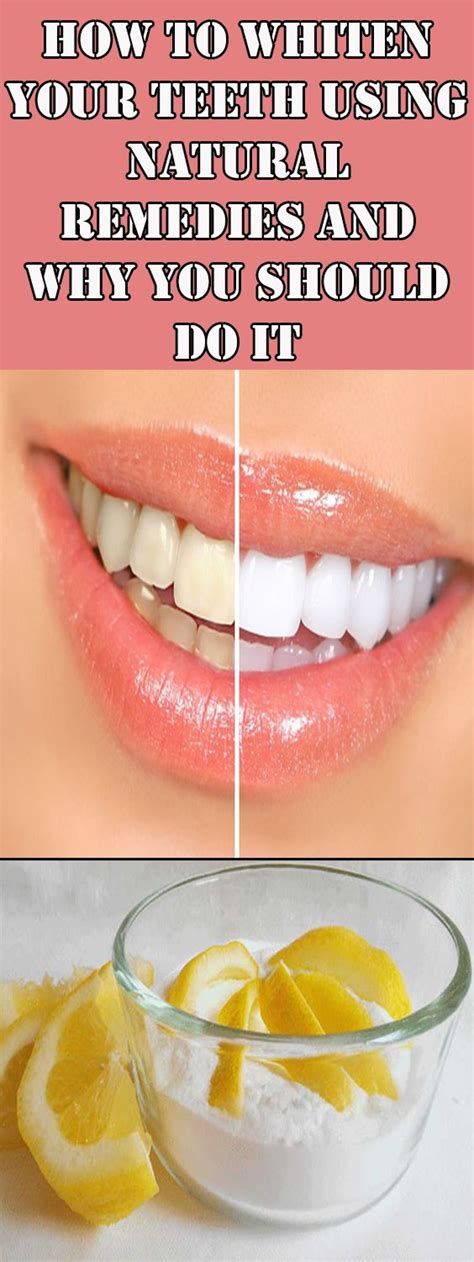 How To Whiten Your Teeth Using Natural Remedies And Why You Should Do