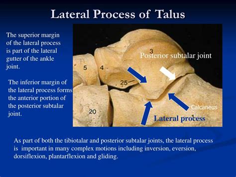 Talus Anatomy Ct