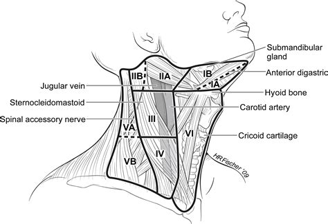 Surgical Management Of Cervical Lymph Nodes In Differentiated Thyroid