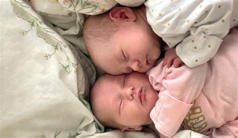 Study Of Twins Shows Its Genetics That Controls Abnormal Development