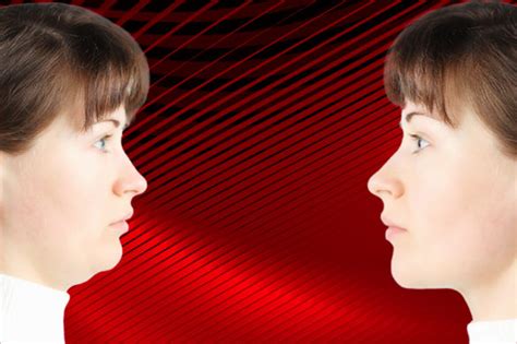 How To Improve Your Side Profile Bite Correction