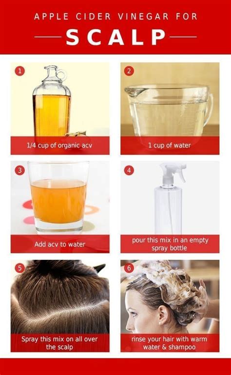 How To Use Apple Cider Vinegar For Dry Itchy Scalp In 2020 Dry Itchy
