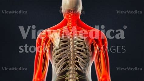 Viewmedica Stock Art Pain In Neck Shoulders And Arms