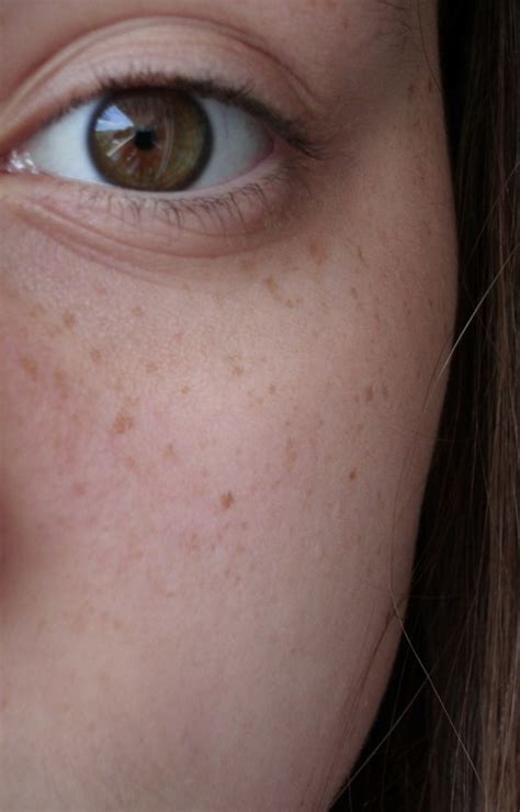 Eye Freckles On Tumblr