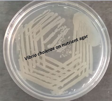 Vibrio Cholerae On Nutrient Agar And Its Details Pathogenecity Lab Diagnos
