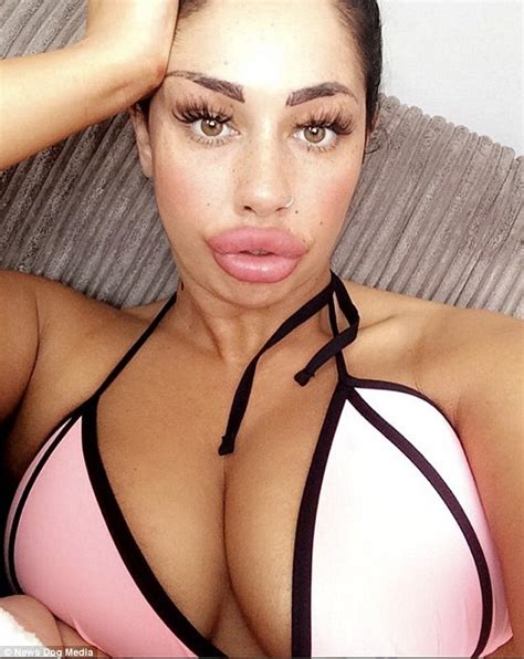 Liverpool Mother Who Spent K On Lip Fillers Says She Wants To Go Even
