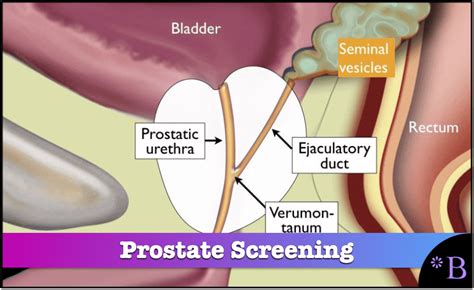 Does Prostate Screening Improve Patient Outcomes Brightwork Research Analysis