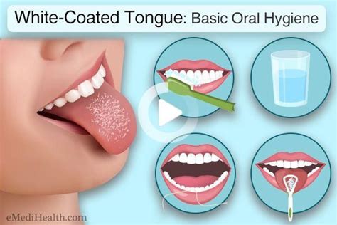 How To Get Rid Of A White Tongue Emedihealth White Tongue White