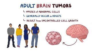 Adult Primary Brain Tumor Notes Diagrams Illustrations Osmosis