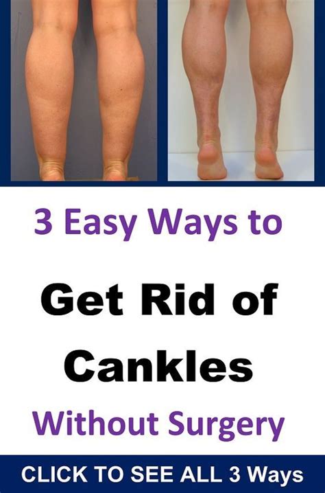 3 Easy Ways To Get Rid Of Cankles Fast Calf Muscle Workout Toned Legs Workout Calf Slimming