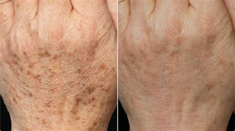 Simple Science: How to Make a Volcano with Kids